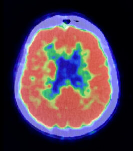 Colorful MRI brain scan.