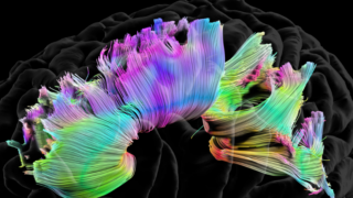 A photo of a brain with various colors