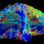 A type of MRI scan (artificially coloured) shows the brain of a person with Alzheimer’s disease.Credit: Mark and Mary Stevens Neuroimaging and Informatics Institute/Science Photo Library