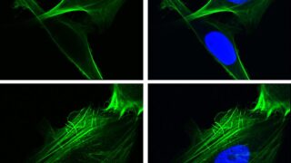 Researchers from the Keck School of Medicine of USC used imaging techniques to study how the protein GRP78 controls cancer cell behavior. In the top row, human lung cancer cells were engineered to over-express GRP78 in the nucleus. In the bottom row, cells lacked GRP78 in the nucleus. The green staining depicts the cytoskeletal protein F-actin which controls cell shape and motility and the blue staining depicts the nucleus. (Image courtesy of Ze Liu, Ph.D, and Amy Lee, PhD)