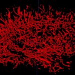3D-rendering of whole brain cerebral small vessels from a healthy volunteer acquired in 8 minutes. Photo credit: USC Stevens INI