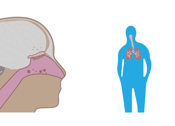 air pollution and dementia