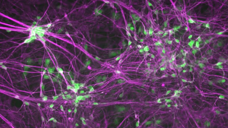 Human induced motor neurons. Motor neurons are green, and neurons are purple. (Image courtesy of the Ichida Lab)