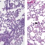 Research image shows inflammation in mouse lung cells on left and reduced inflammation from by treatment with Yoda1 on the right.