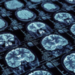 image shows multiple brain scans.
