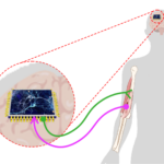 Image shows representation of the integration of brain-computer-interface technology and regenerative medicine