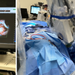 On the left, the computer screen displays the video image and two OCT images taken during the surgery. On the right, Oghalai is collecting data while performing the surgery. Photo/John Oghalai.