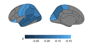 Figure of two brains with regions outlined and shaded in grey and various shades of blue, indicating higher HbA1c levels