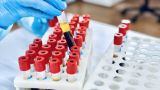 laboratory technician holding a blood tube test