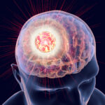 A human brain with a radiant light shining through.