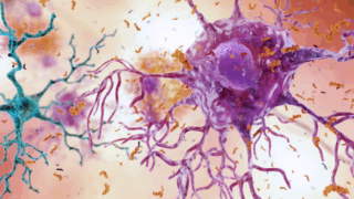 USC Dornsife researchers and collaborators are building an open-source network to improve early detection of Alzheimer’s disease and related dementias.