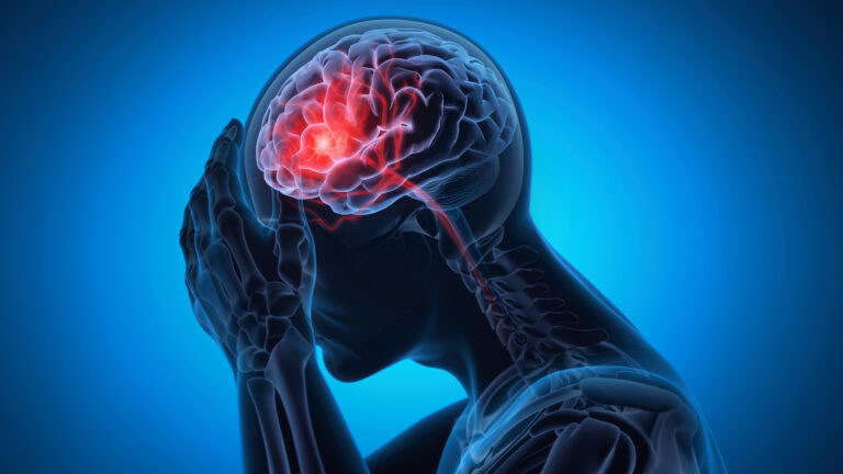 Man with a headache - Brain Stroke - X ray 3D Illustration with blue background