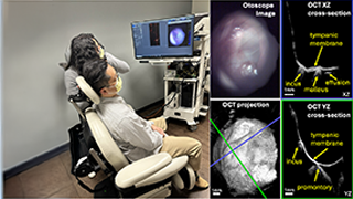 Left) Technician imaging the ear of a volunteer with a prototype Optical Coherence Tomography (OCT) otoscope. Right) An otoscope image and OCT cross-sections of a patient presenting with a retraction pocket, illustrating the depth of the retraction and its contact points with the incus and cochlear promontory. (Photo Credit: Applegate Research Group)
