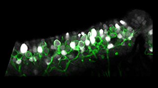 Sensory hair cells and neurons. Photo Credit: Radha Kalluri.