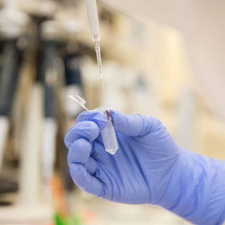 gloved hand with pipette