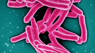 Mycobacterium Tuberculosis Bacteria, the Cause of TB Scanning electron micrograph of Mycobacterium tuberculosis particles (colorized red), the bacterium which causes TB. Credit: NIAID