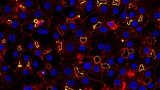 Human cells under a microscope