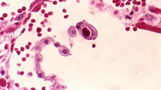 Human lung cells