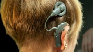 Cochlear implant exterior gear