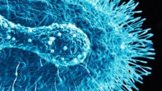Monkeypox virus