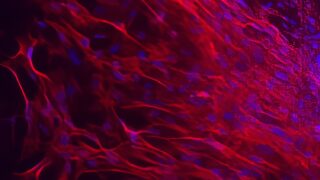 Muscle stem cells