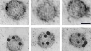 neuronal exosome