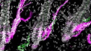 Hair follicle, Arrector pili muscles and Sympathetic nerves (image by Yulia Shwartz)