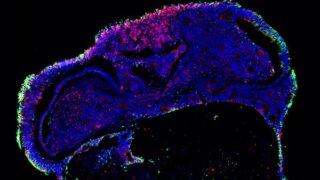 Cryosection of a 3-month human brain organoid stained for markers of cortical projection neurons. CUX1 green, BRN2 red counterstained with DAPI. (Image by Giorgia Quadrato)