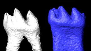 molar root