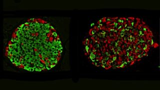 Normal mouse islet (left); mouse islet where insulin cells have been reprogrammed into glucagon cells (right) (Image courtesy of the Georgia Lab)