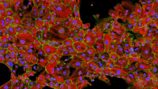 Cardiomyocytes Deep Field