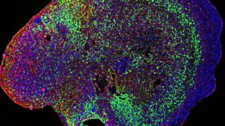 cerebral organoid