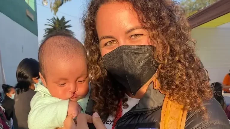 woman in mask with infant with cleft lip
