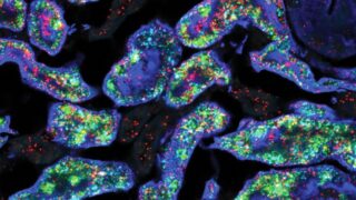 Genes under a microscope