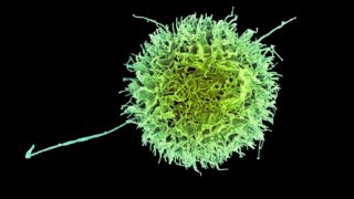 Natural killer cell. Courtesy of Wikipedia/Creative Commons