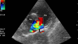 Clinical Ultrasound image