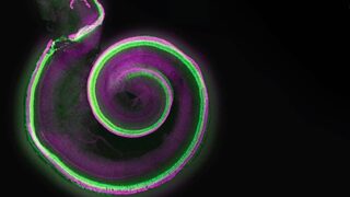 Cochlear cells in a spiral