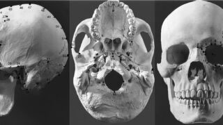 craniofacial 3d image