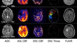 Mouse brain scans