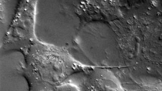 Intercellular connections in a549 cells. Gold nanorods (25x73 nm) are present.