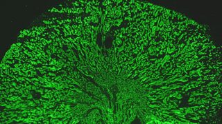 Kidney fluorescing