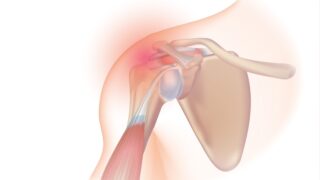 rotator cuff