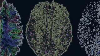 three-view brain scan