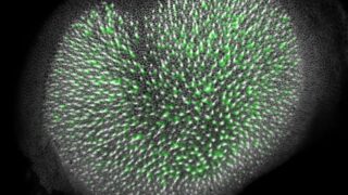 Utricle