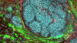 USC Viterbi biomedical engineers have designed a new protein that targets and disables tumor cells’ defenses while marking cancer cells for death.