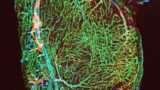 lymphatics