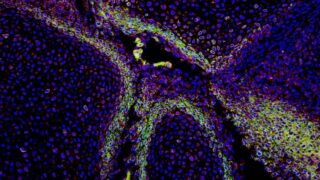 Developing metacarpals of the hand (Image courtesy of the Evseenko Lab)