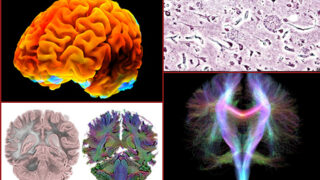 Montage of brain images
