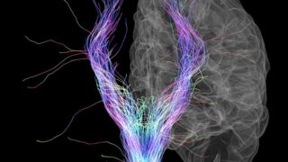 Scan of human brain with artificial color applied