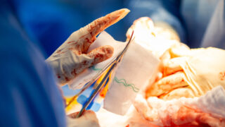 Close up of the hands of doctors performing an operation on a patient in the operating room of a hospital.